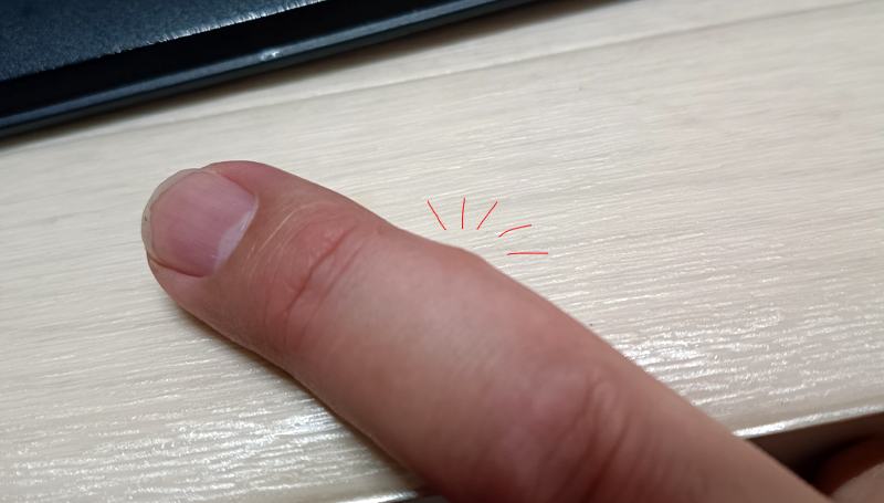 釣行中にヌカカに刺されて腫れた指